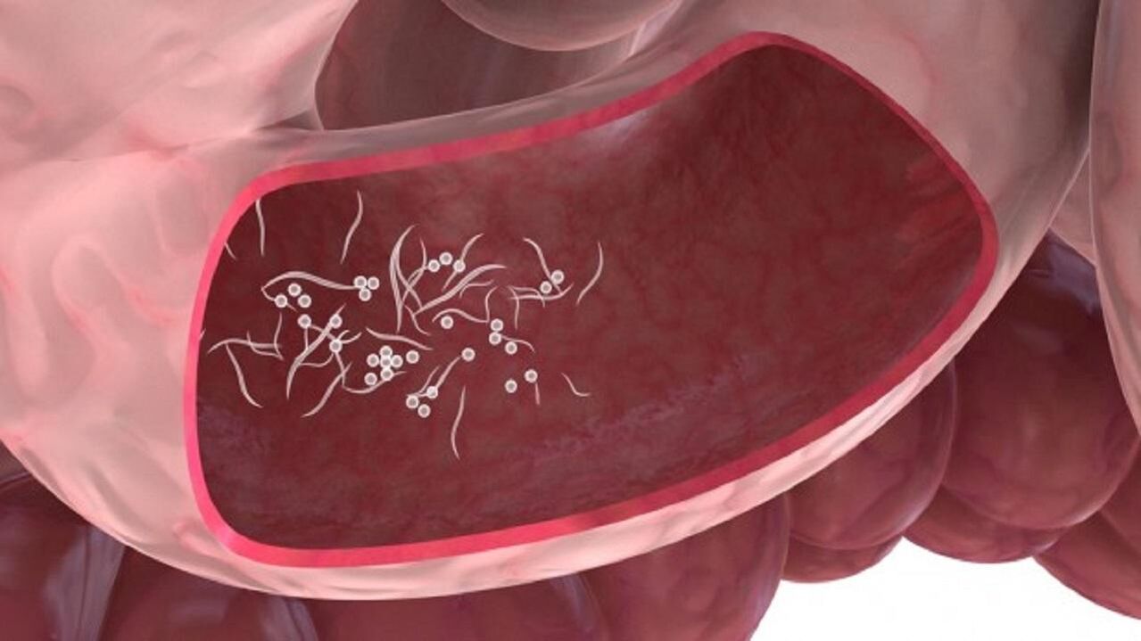 Giardia parazituje v játrech