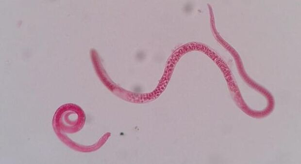 jak vypadají trichinely