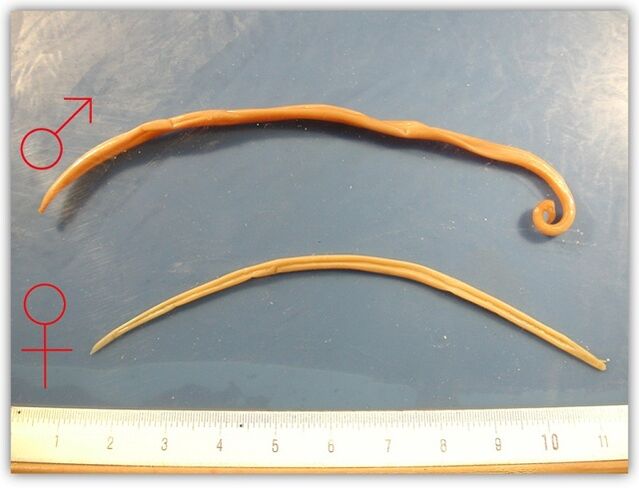 jak vypadají škrkavky