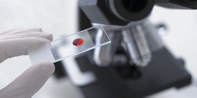 krevní test k diagnostice parazitů v těle